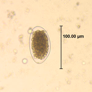 Trichostrongylus_egg_wtmt_HB1.jpg