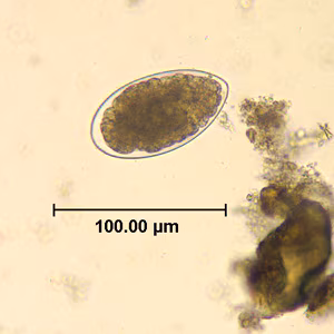 Trichostrongylus_egg_wtmt_HB2.jpg