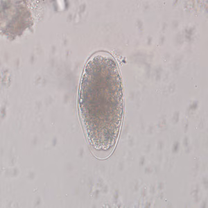 Trichostrongylus_egg_wtmt_IN1.jpg