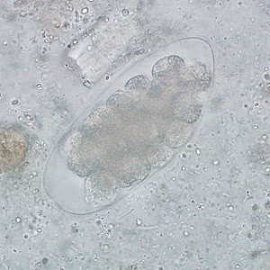 Trichostrongylus_egg_wtmt_IN2.jpg
