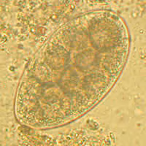 Trichostrongylus_Netherlands_A.jpg