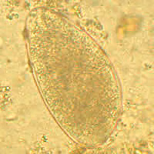 Trichostrongylus_Netherlands_B.jpg