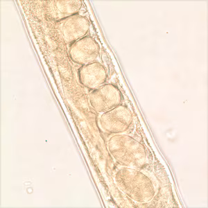 Trichostrongylus_female_midsection_200x.jpg