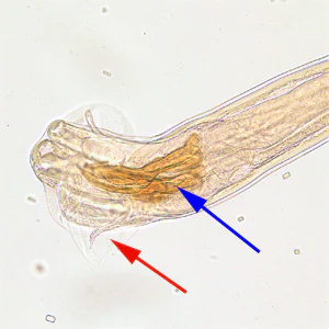 Trichostrongylus_male_posterior_200x.jpg