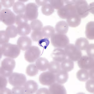 Tcruzi_thin_giemsa4.jpg