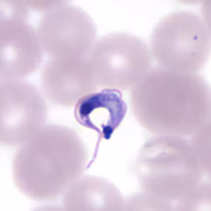 Tcruzi_thin_giemsa4_zoom.jpg