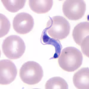 Tcruzi_thin_giemsa5_zoom.jpg