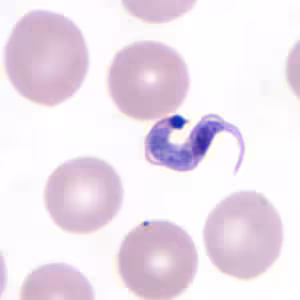 Tcruzi_thin_giemsa6_zoom.jpg