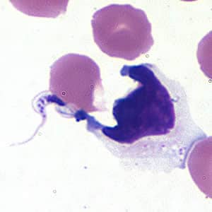 Tcruzi_CSF_giemsa.jpg