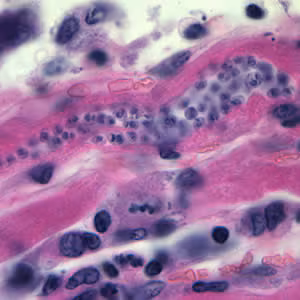Tcruzi_tissue_he.jpg