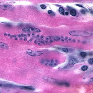 Tcruzi_tissue_he2.jpg