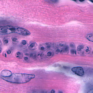 Tcruzi_tissue_he2_zoom.jpg