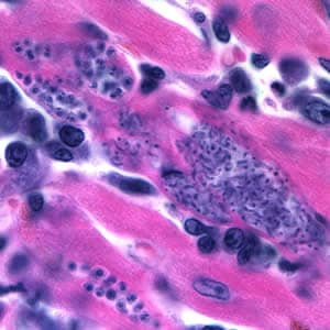 Tcruzi_tissue_he3.jpg
