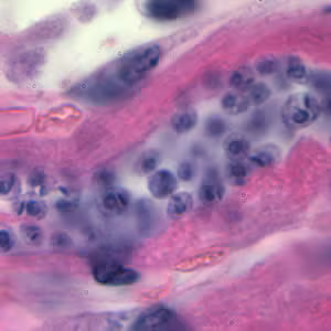 Tcruzi_tissue_he_zoom.jpg