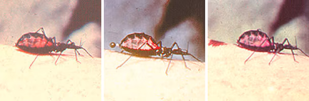 Tcruzi_triatomid_bite.jpg