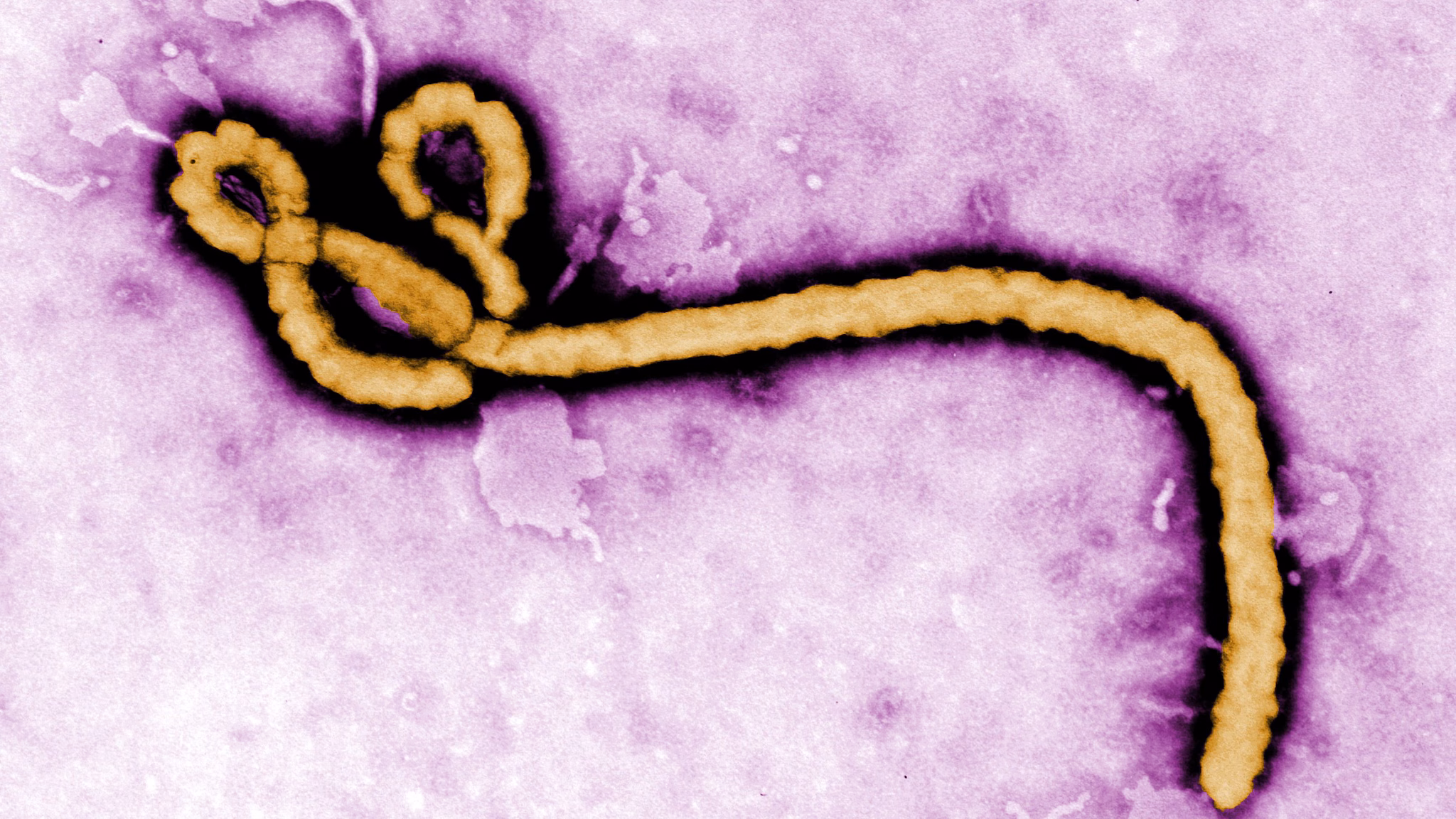Microscopic image of the Ebola virus