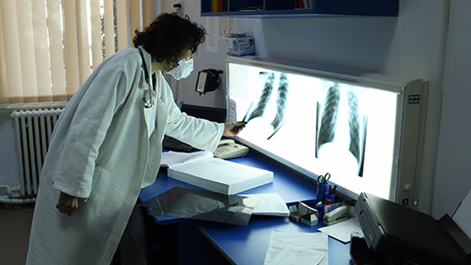 2024-05-HIV-Overview_QA-Programs-TB-Testing_TM_660x372 A woman in a white coat looks at chest X-rays.