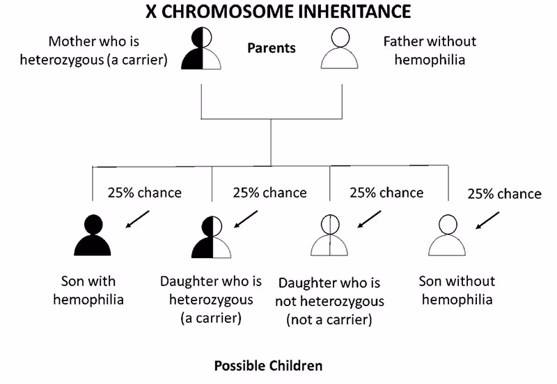 Diagram that explains percent chance of hemophilia inheritance if mother is a carrier and father does not have hemophilia.