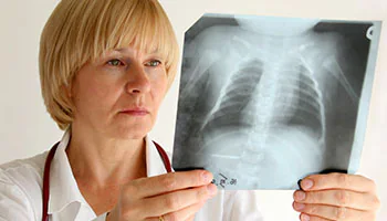 Healthcare provider x-ray Healthcare provider observing an x-ray of the chest.