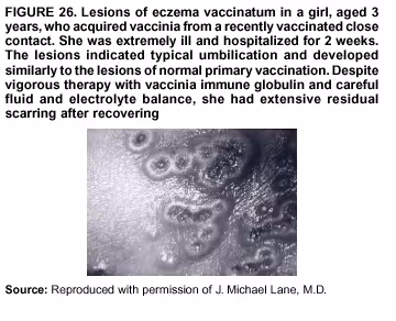 Figure 26