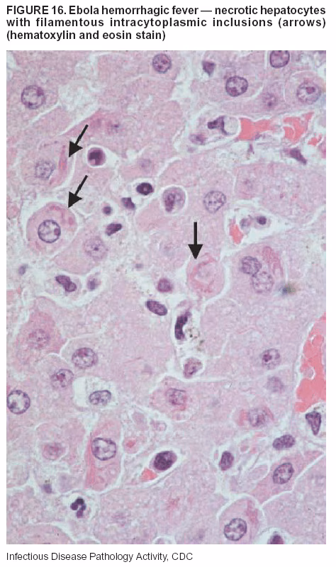 Figure 16