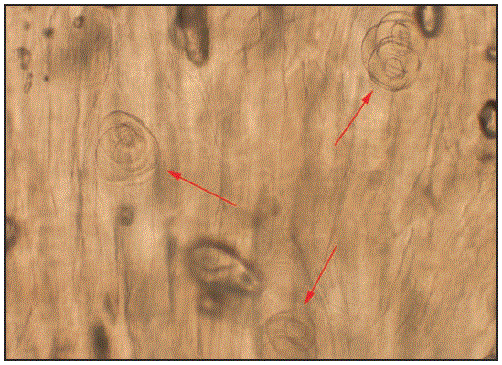 mm6708a3-F The figure above is a microscopic image of Trichinella spiralis encysted within implicated raw pork, in California in 2017.