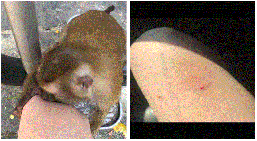 mm6909a6-F The figure consists of two photos; one shows a macaque biting an Oregon teen on the leg, and the second shows the resultant wound.