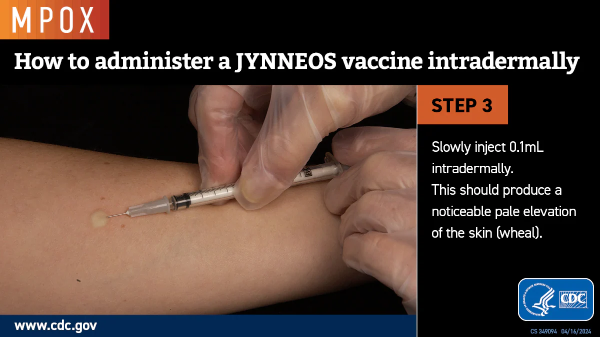 Intradermal Injection Step 3 Photo showing a small, pale elevation of the skin where injection occurred.