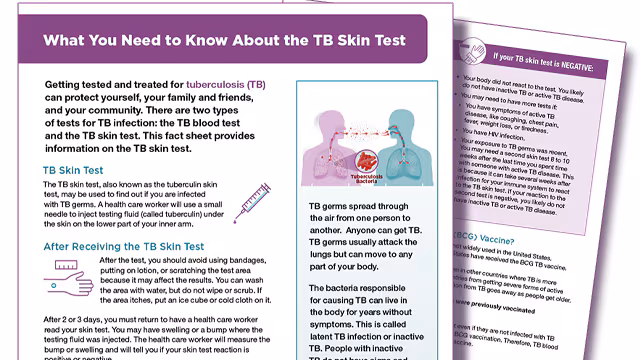 skinTestingInformationfactsheet.jpg TB Skin Test Infographic
