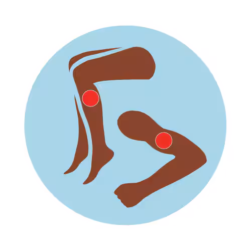 -- title missing -- Illustration of blood clots in arm and leg.