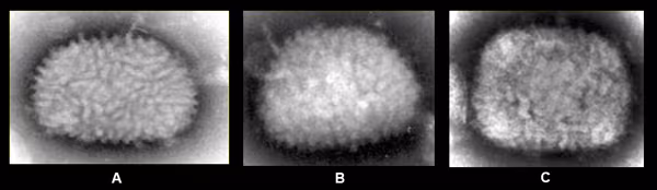 Figure 3 Images of vaccinia virus, smallpox virus, and mpox virus from clinical specimens