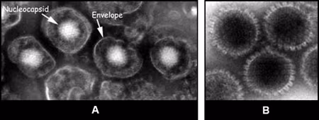 Figure 6 Images of herpesvirus particles from tissue culture
