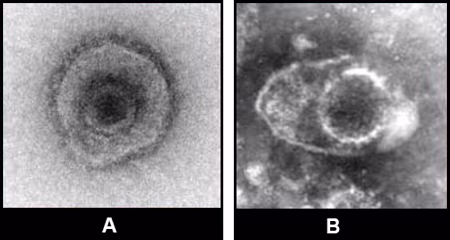 Figure 7 Images of herpesvirus from clinical specimens