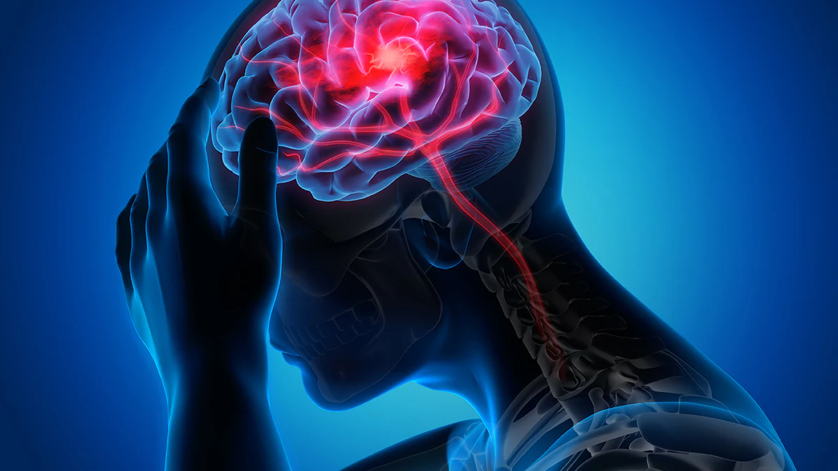 Signs and Symptoms of Stroke Illustration of a person holding their head with the brain highlighted