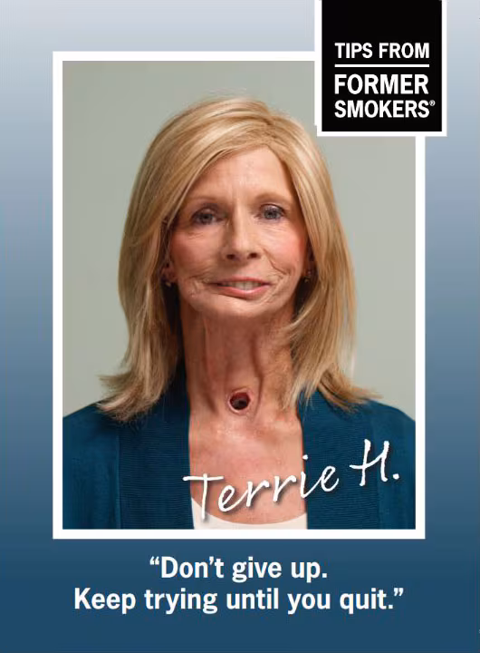 Terrie H. Don not give up hope. Keep trying until you quit.