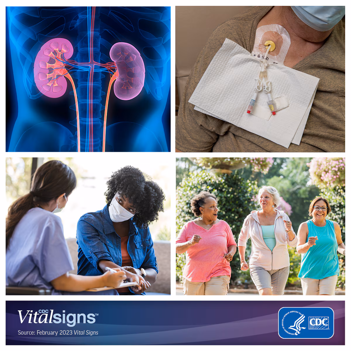 Photo collage of kidneys, patient set up for dialysis, nurse asking a patient questions, and a trio of women jogging.