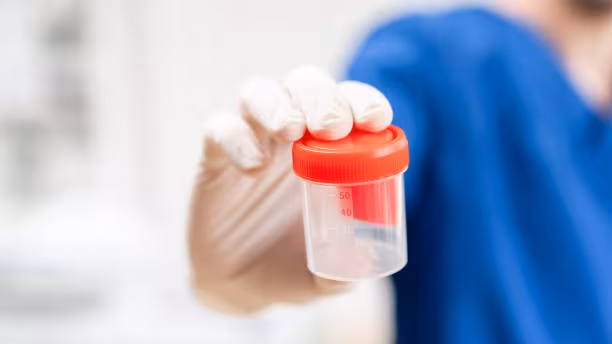 Nurse holding a urine cup